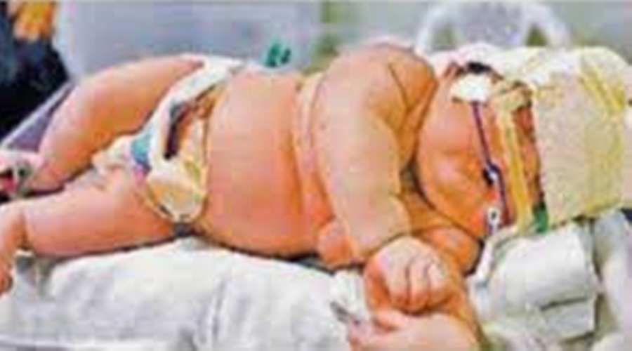 A seven kg baby was born; The doctor is also surprised to see the baby