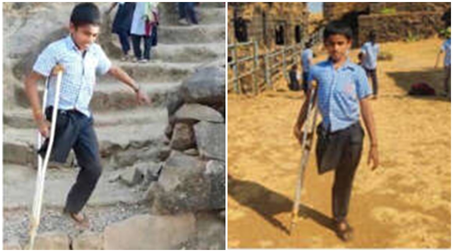 Even though one of his legs is missing, the sixth-grader climbed Raigad Fort!