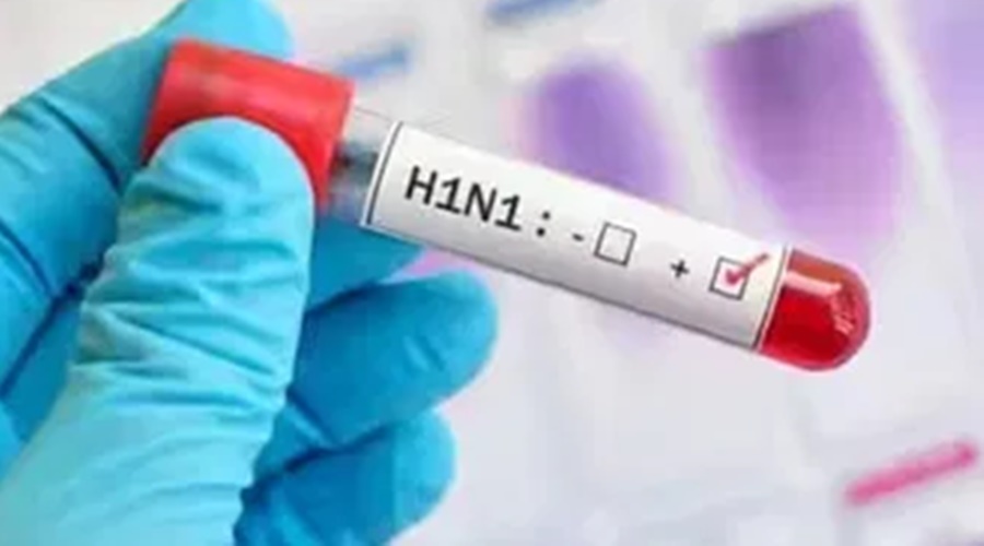 Big Breaking! First patient of H3N2 died in Ahmednagar, tension in Maharashtra increased