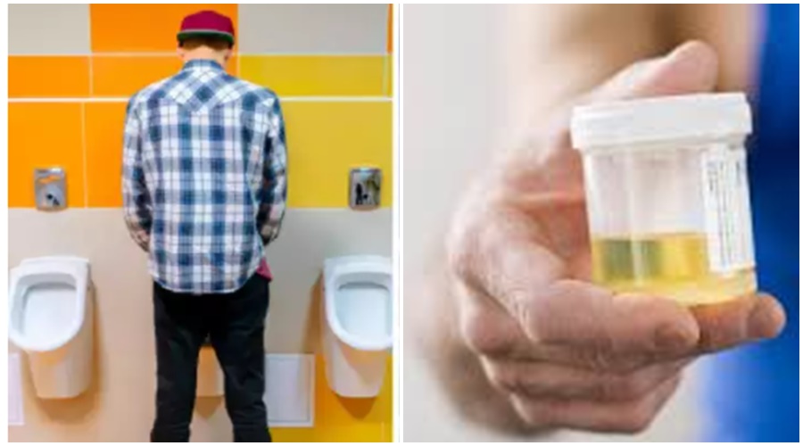 'Ha' failure in urine is a sign of heart disease! Know more...