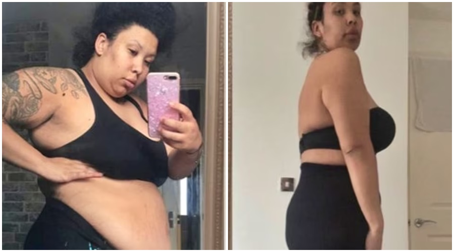 Weight Loss | To lose weight, the woman spent 3 lakhs and underwent surgery. The weight was also reduced, but... reading the next example will shock you