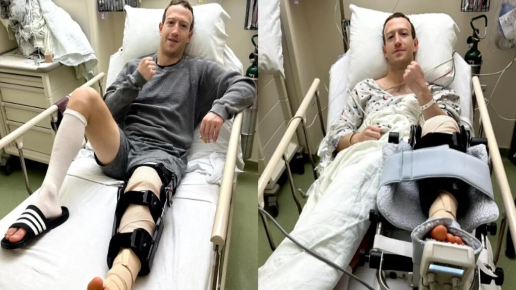 Mark Zuckerberg Injury